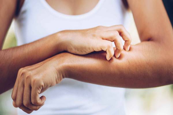9 Main Causes Of Itchy Body: (What To Do)